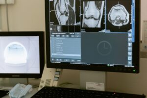 UGT denuncia el grave déficit de radiólogos en el hospital de Torrevieja y la externalización del servicio