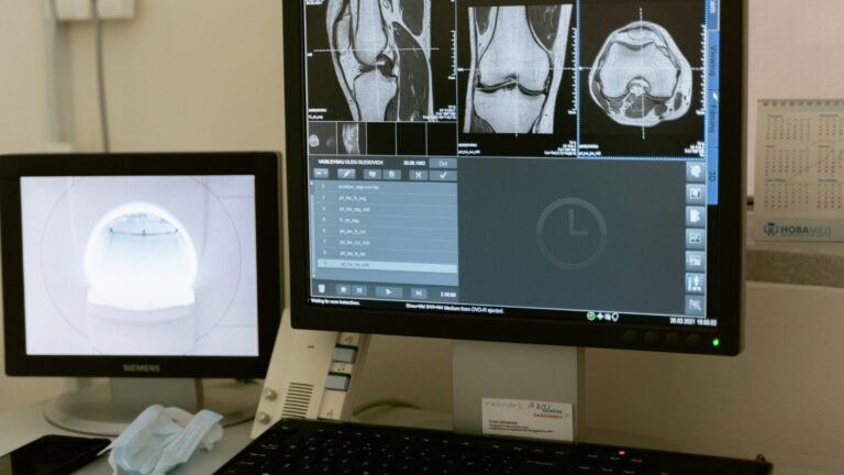 Lee más sobre el artículo UGT denuncia el grave déficit de radiólogos en el hospital de Torrevieja y la externalización del servicio